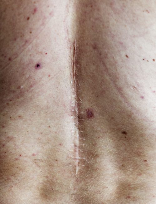 Réflexologie réparatrice et cicatrice